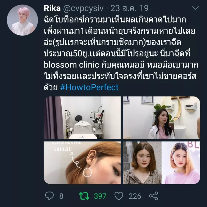 รีวิวจากผู้ใช้บริการ ฉีดโบท็อกลดกราม