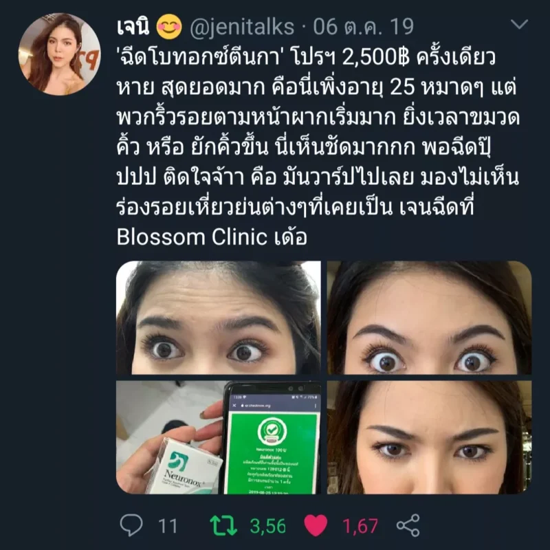 รีวิวจากผู้ใช้บริการ ฉีดโบท็อกลดตีนกา ลดริ้วรอย