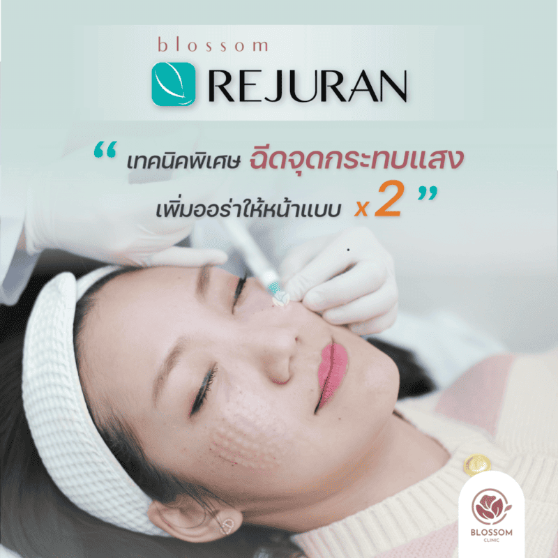 เทคนิคการฉีด REJURAN