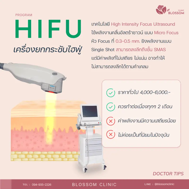 Hifu เครื่องยกกระชับไฮฟู่ เป็นเครื่องยกกระชับใบหน้ารุ่นแรกๆ