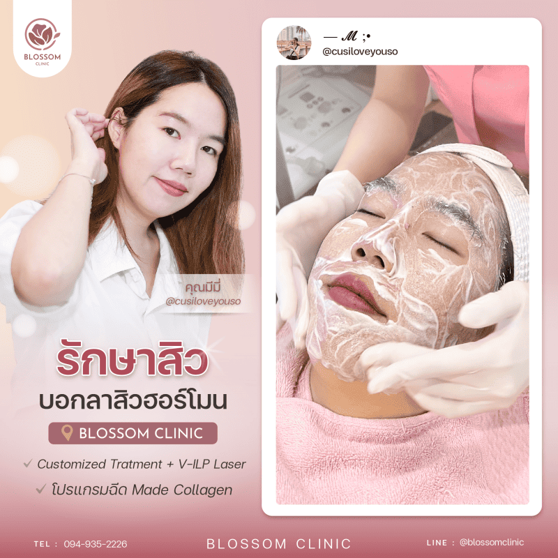 รักษาสิว ที่ Blossom Clinic