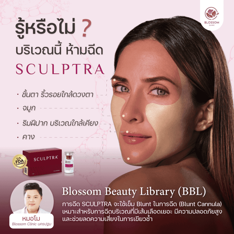 บริเวณที่ไม่ควรฉีด Sculptra | คอลลาเจนคืออะไร