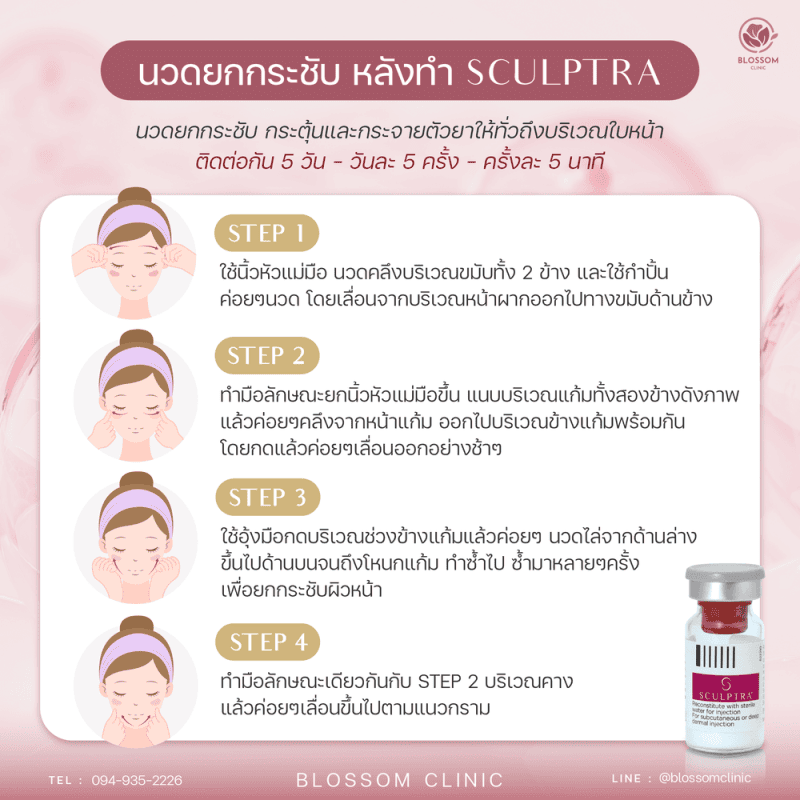 การดูแล นวดหลังทำ Sculptra