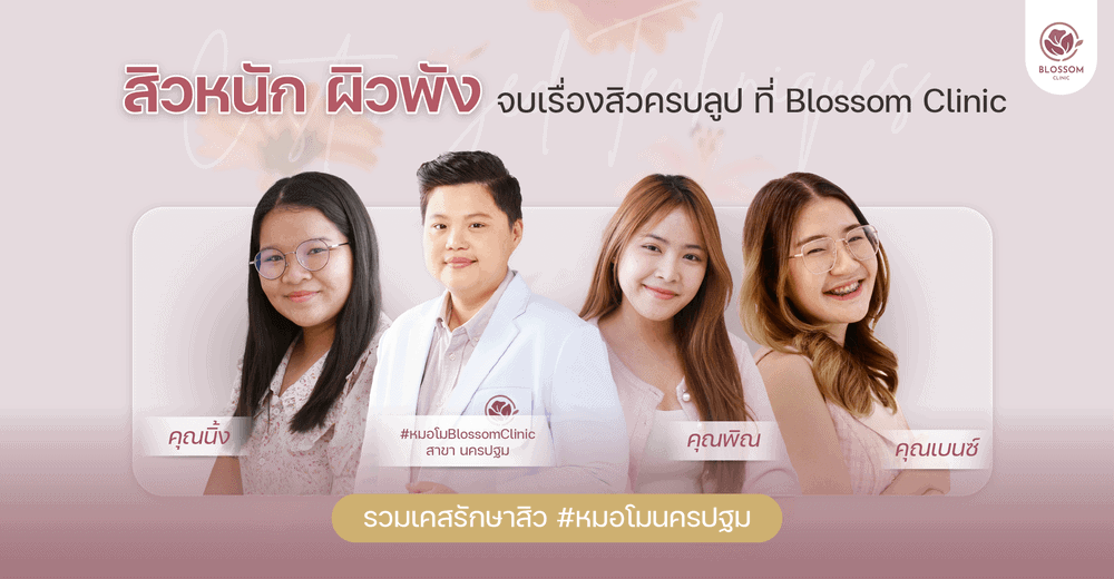 Sculptra กระตุ้นคอลลาเจน ให้ผิวเด้ง หน้าเด็กลง