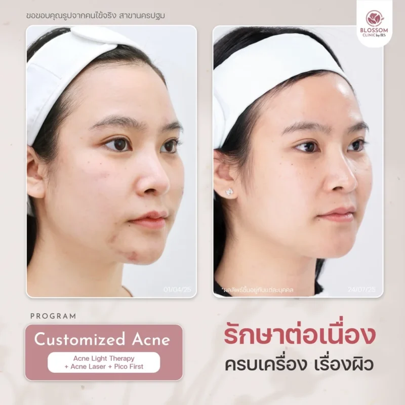 Drip Vitamin จำเป็นอย่างไร? อยากผิวขาวกระจ่างใสห้ามพลาด!