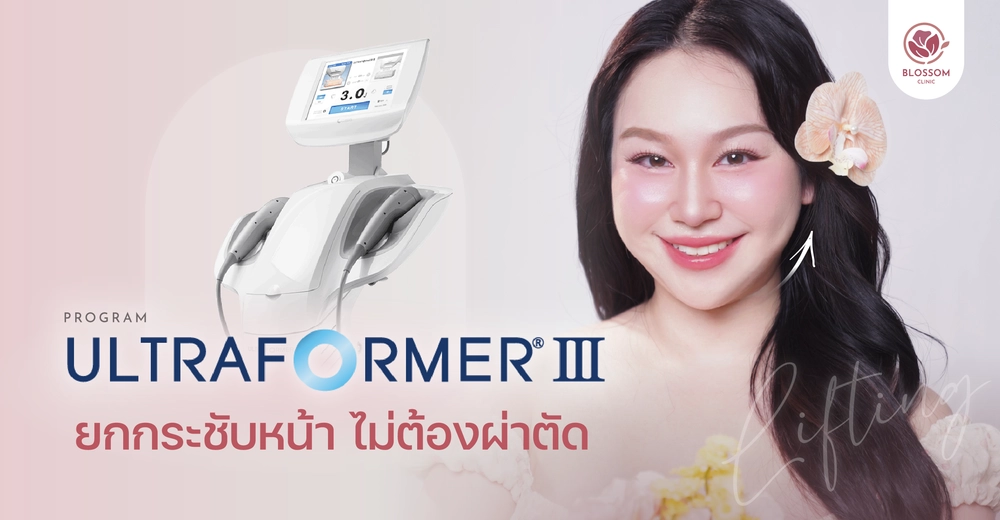โปรแกรม Ultraformer III ยกกระชับหน้า ไม่ต้องผ่าตัด