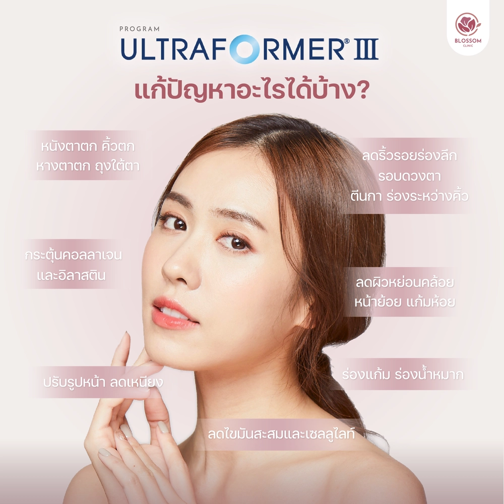 Ultraformer III แก้ปัญหาอะไรได้บ้าง