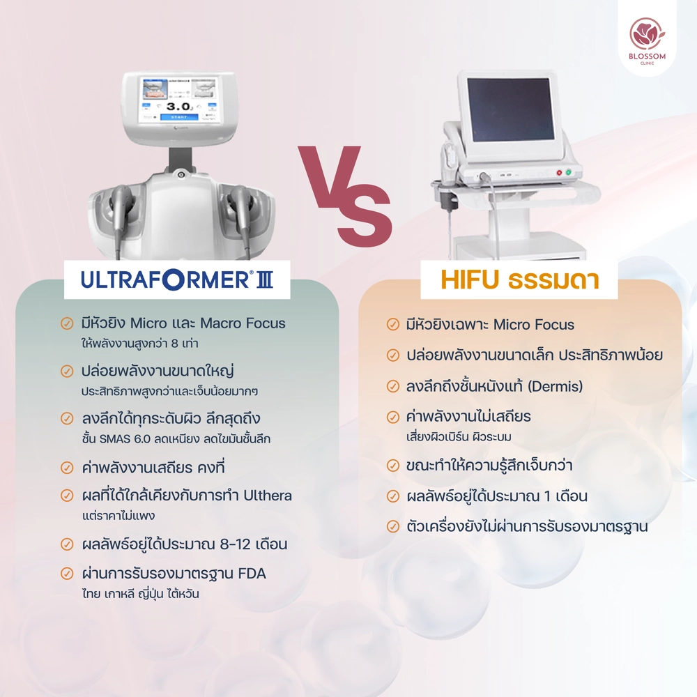 โปรแกรม Ultraformer III กับ HIFU ต่างกันยังไง?