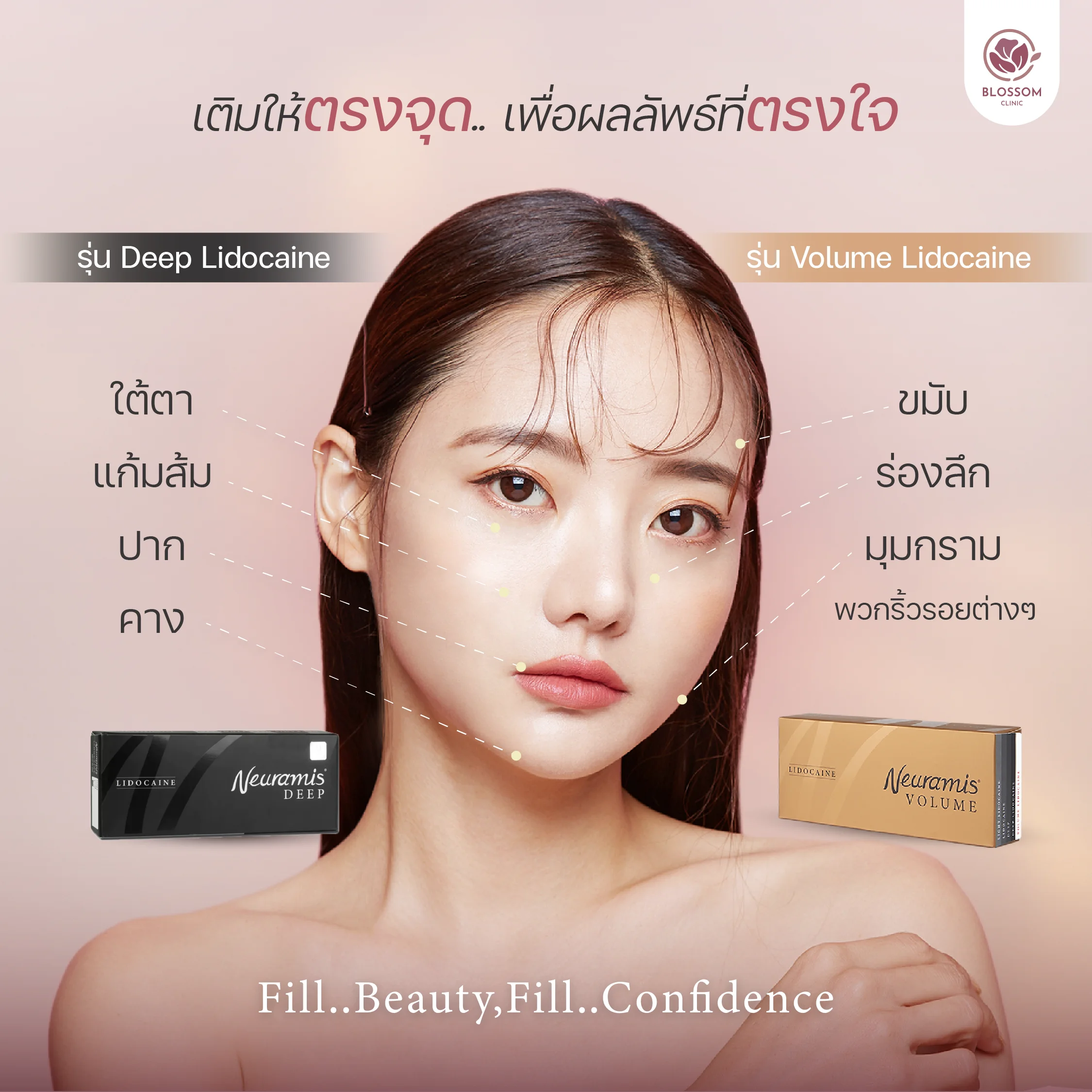 โปรแกรม Filler Neuramis ฉีดรุ่นไหน ตรงไหนดี
