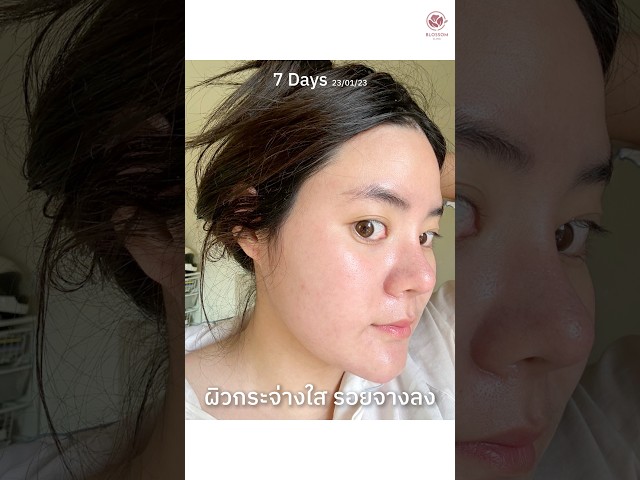 รวมวิดีโอโชว์เคสสุดปัง จาก Blossom Clinic​