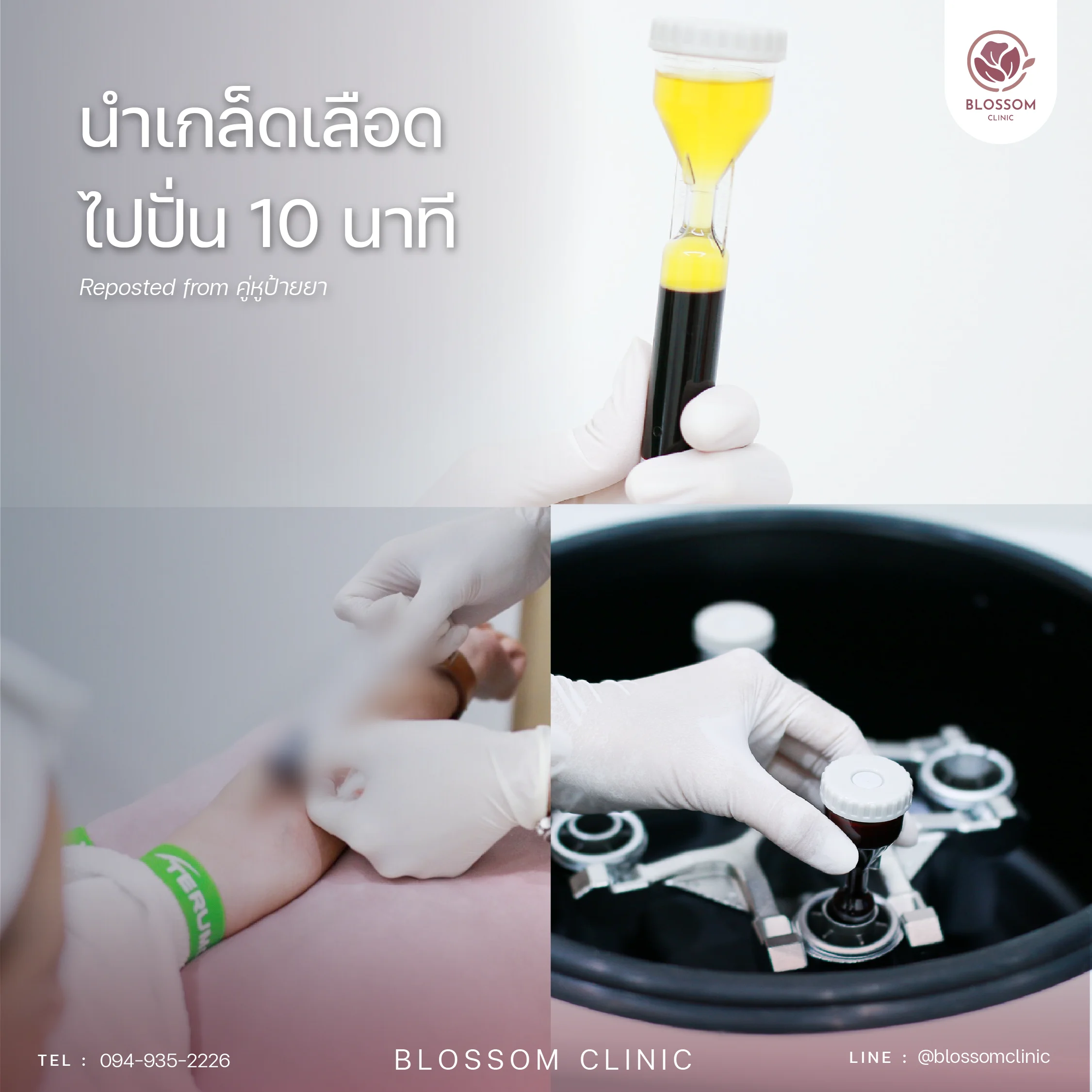 ขั้นตอนการรับบริการโปรแกรม Anti-Hair loss