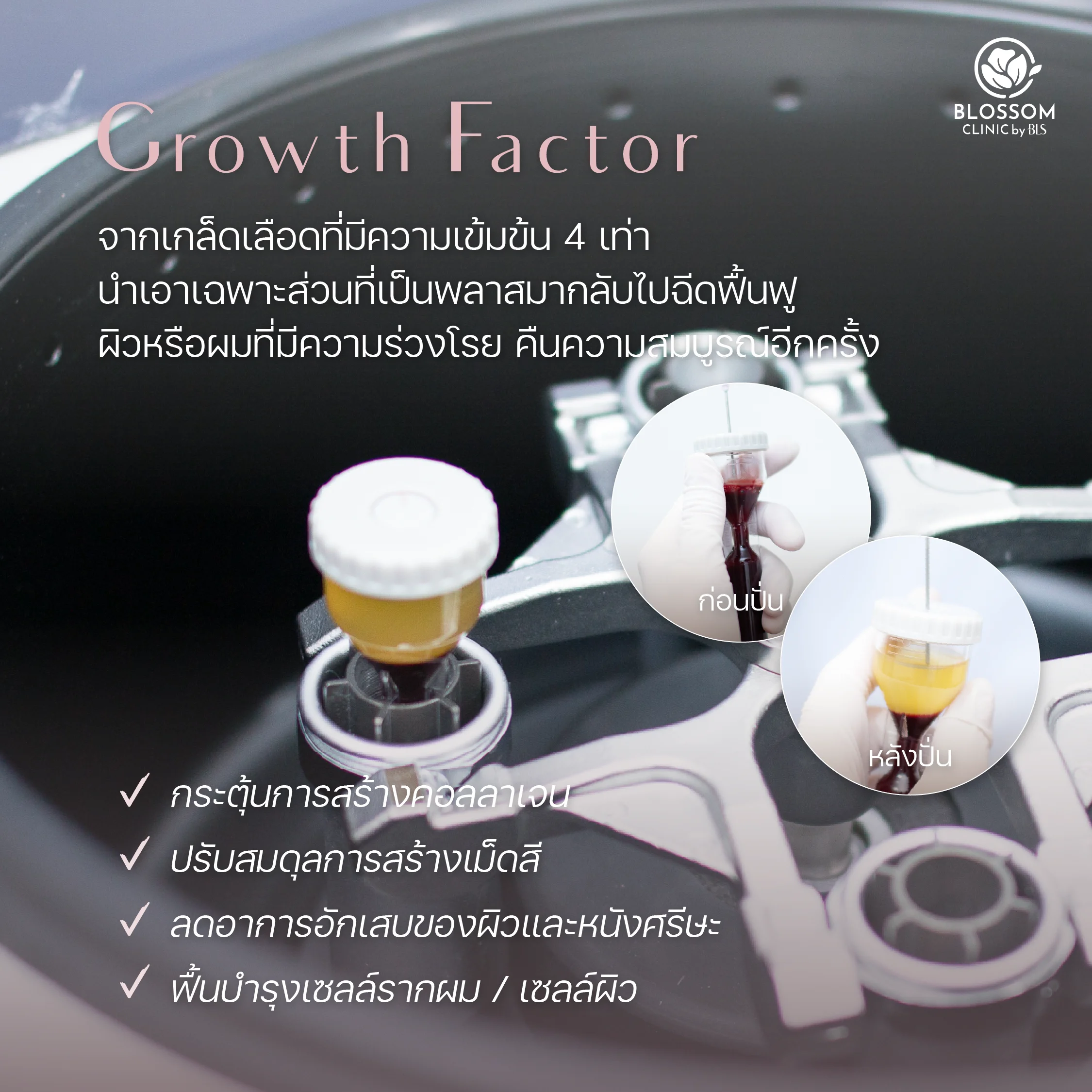 Growth factor จากเกล็ดเลือด ดีอย่างไร?