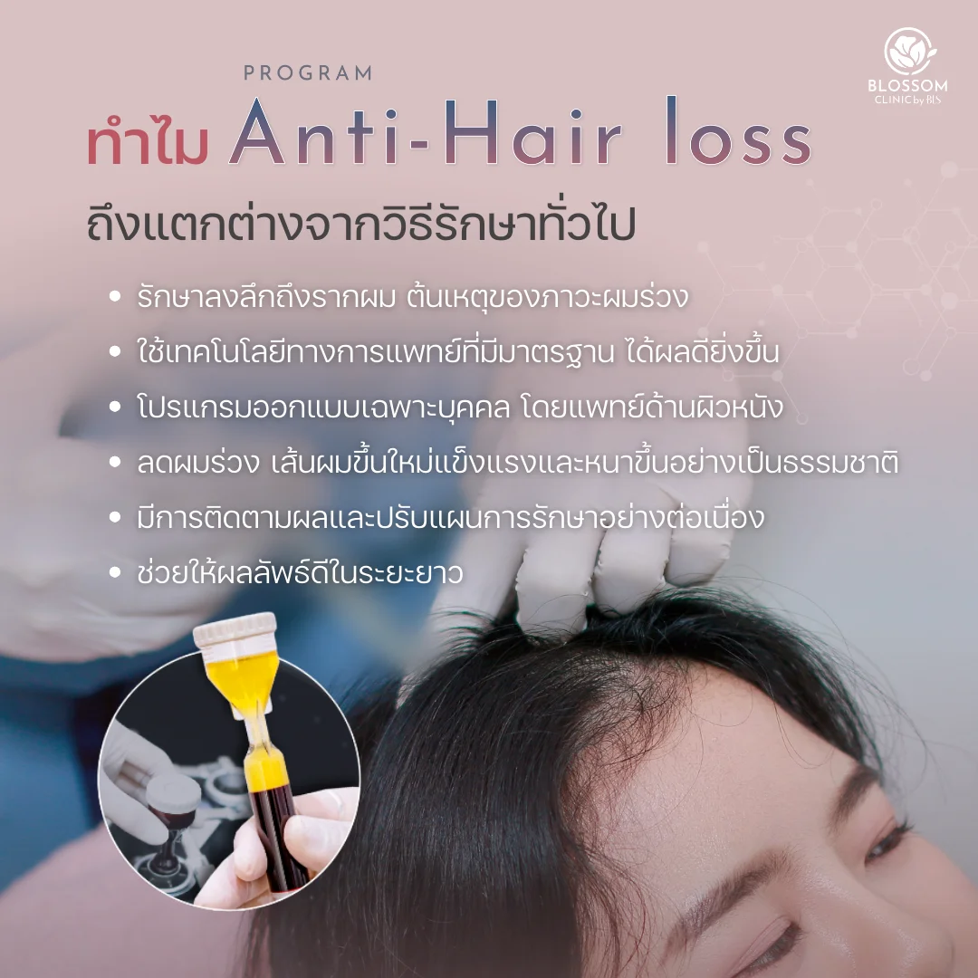ทำไม โปรแกรม Anti-Hair loss ถึงแตกต่างจากวิธีรักษาทั่วไป