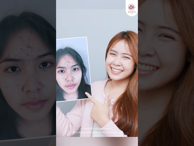 รวมวิดีโอโชว์เคสสุดปัง จาก Blossom Clinic