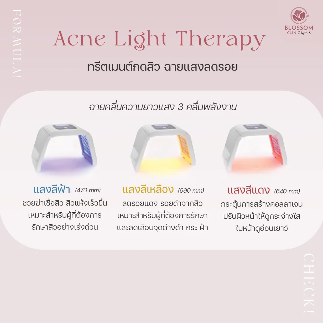 โปรแกรม Acne Light Therapy