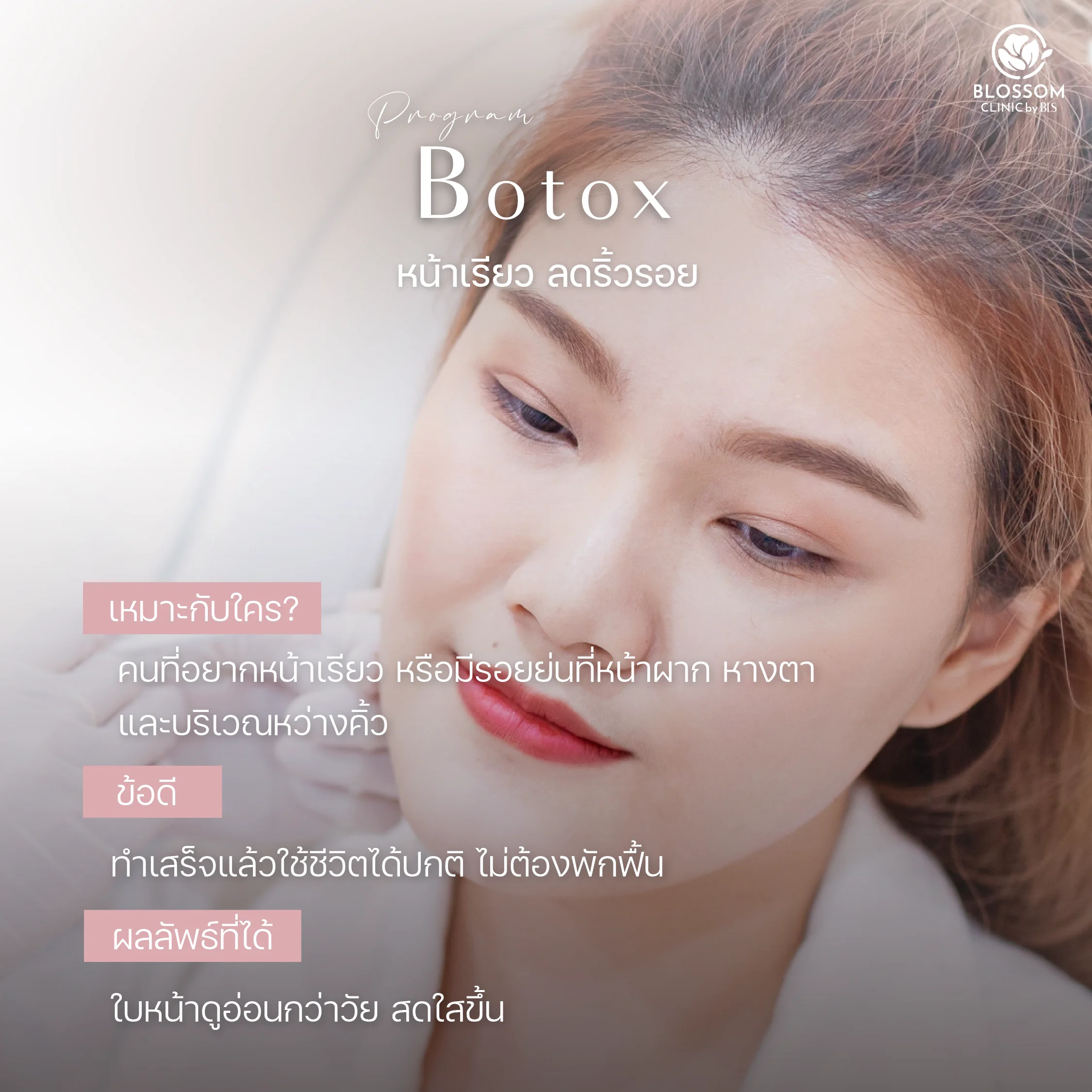 Program Botox หน้าเรียว ลดริ้วรอย