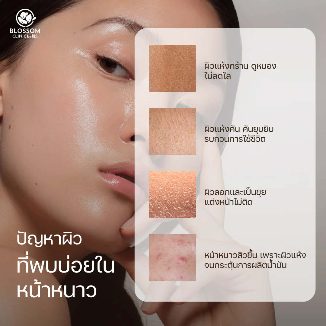 ปัญหาผิวที่พบบ่อยในหน้าหนาว
