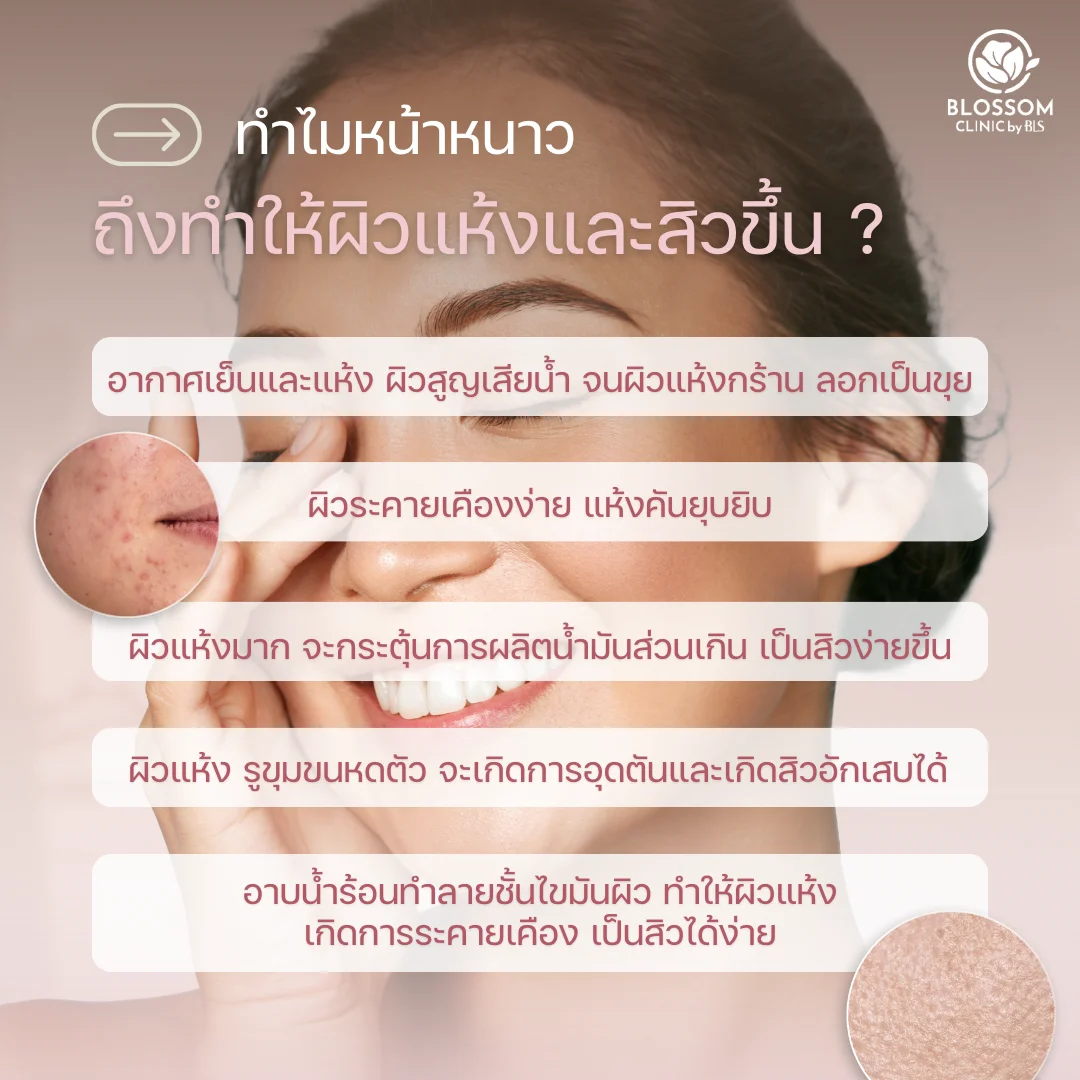 ทำไมหน้าหนาวถึงทำให้ผิวแห้งและสิวขึ้น?