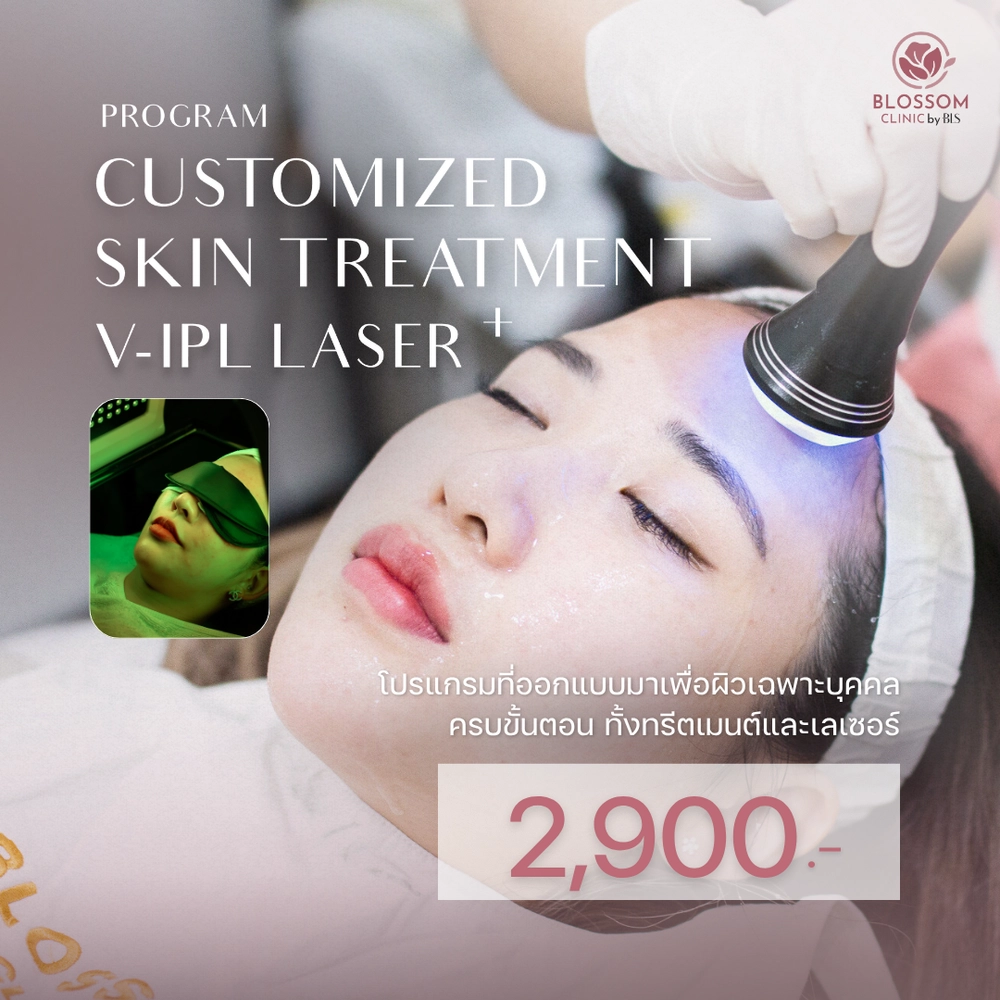 โปรแกรม Customized Skin Treatment + V-IPL Laser