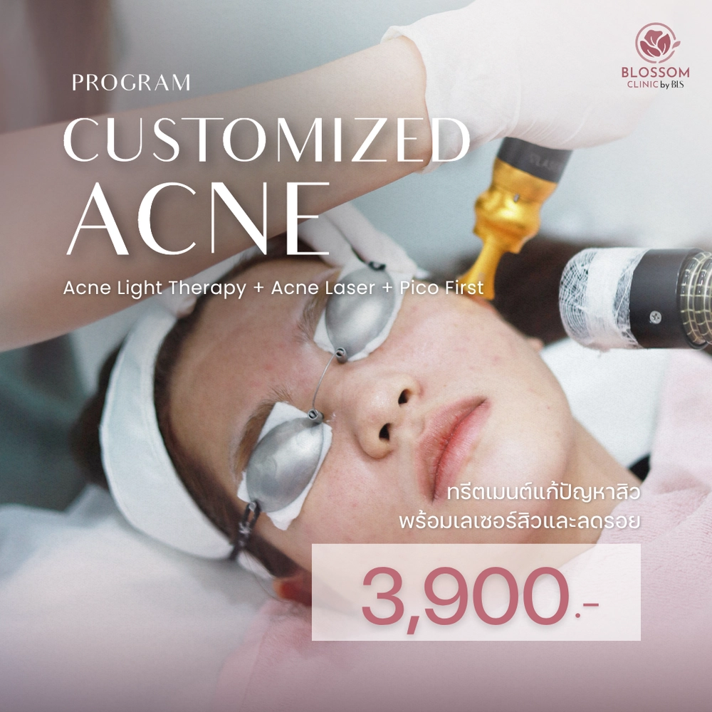 โปรแกรม Customized Acne