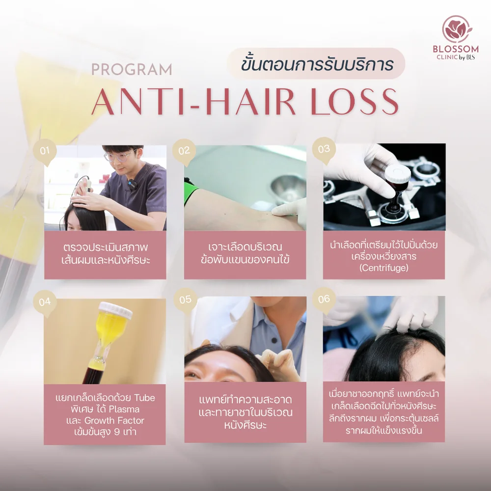 ขั้นตอนการรักษาด้วยโปรแกรม Anti-Hair loss