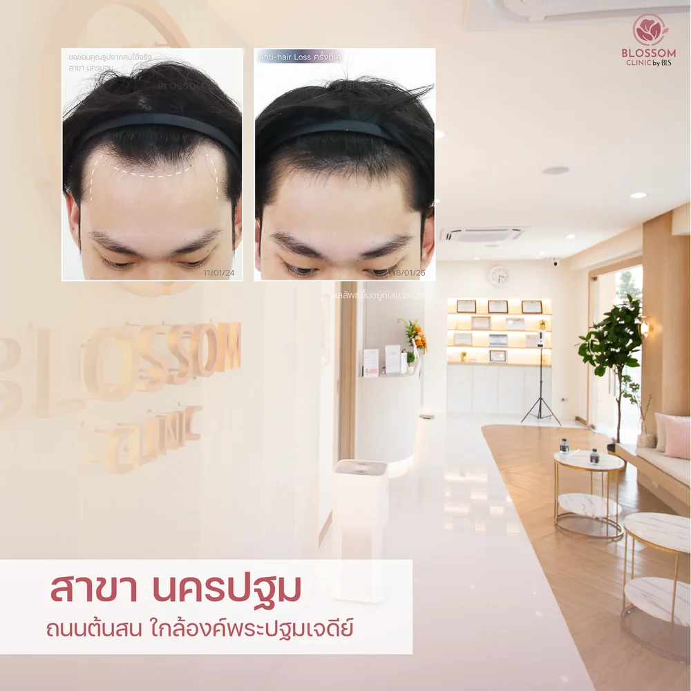 Blossom Clinic Nakhonpathom บลอสซั้มคลินิก สาขานครปฐม