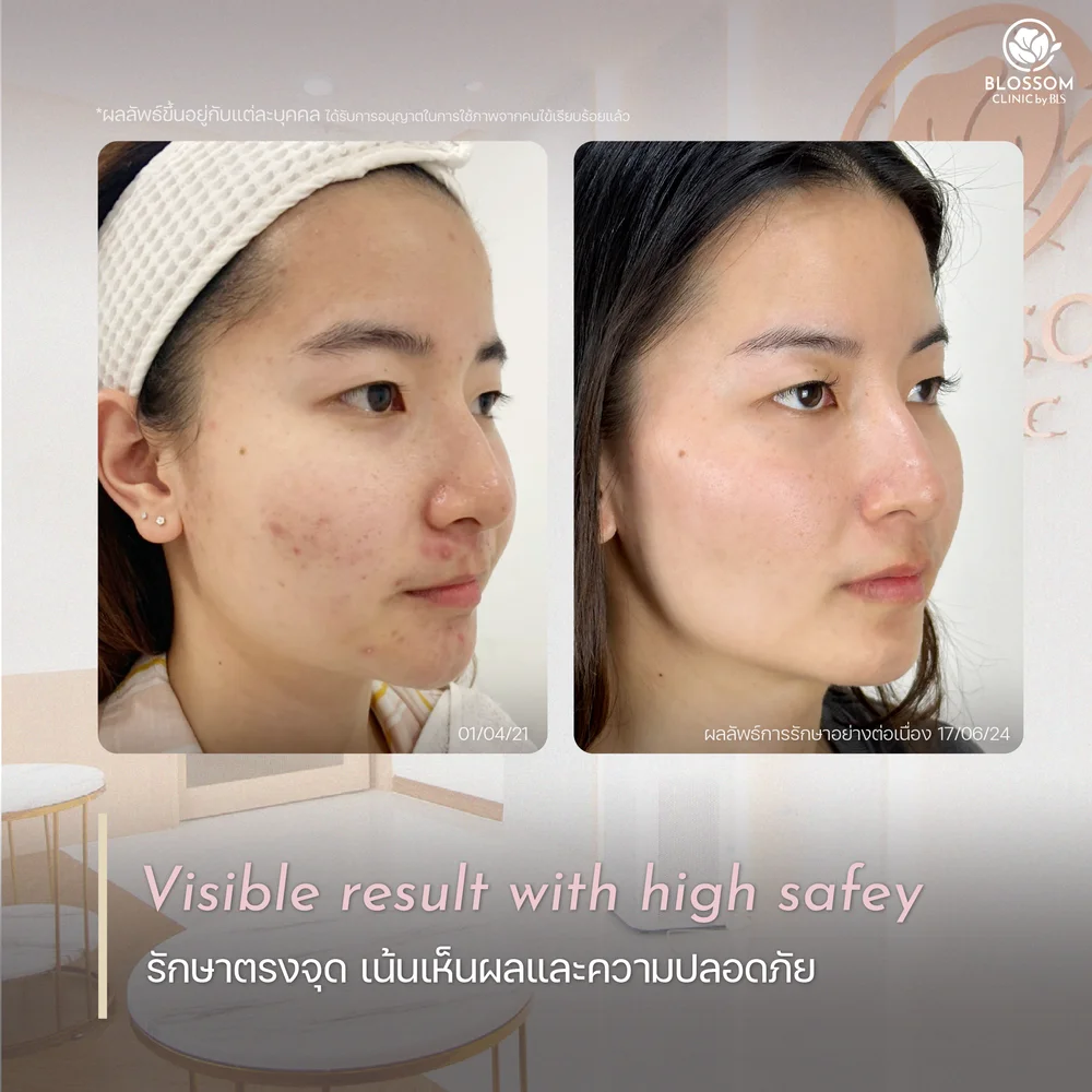 Blossom Clinic รักษาตรงจุด เห็นผล ปลอดภัย