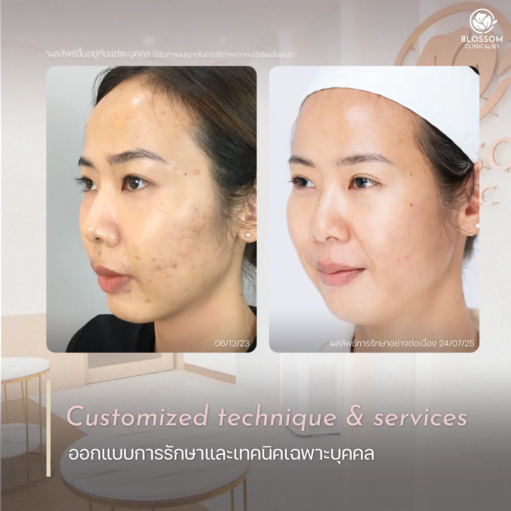 Blossom Clinic ใช้เทคนิคเฉพาะบุคคล