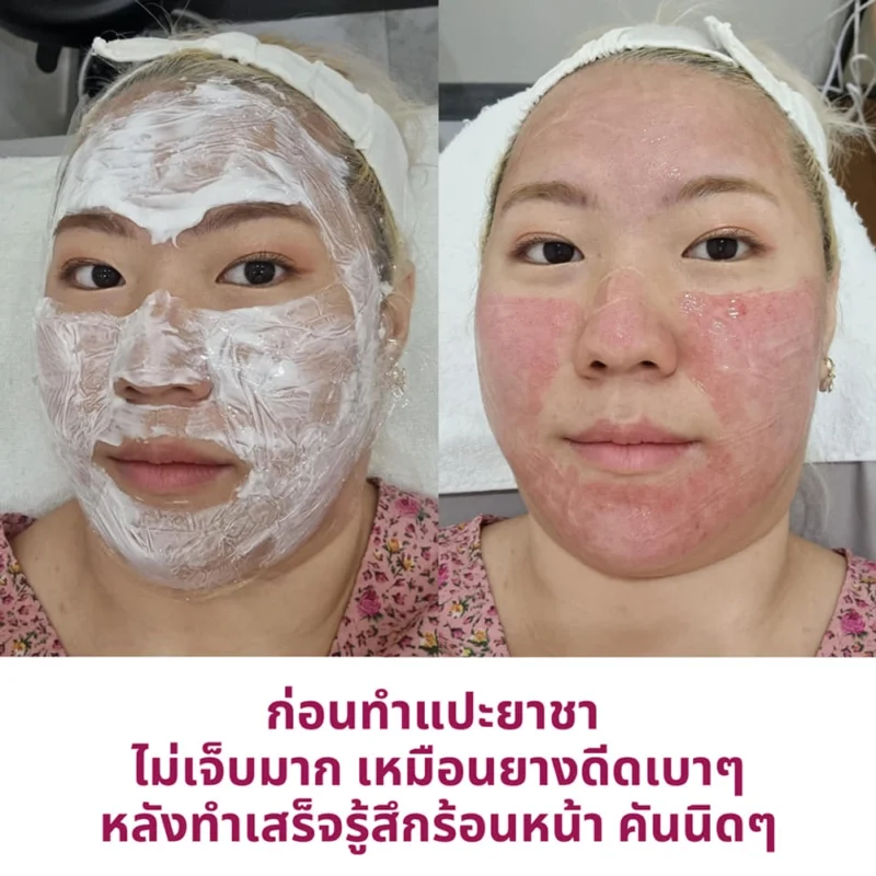 Pico รักษาอะไรได้บ้าง