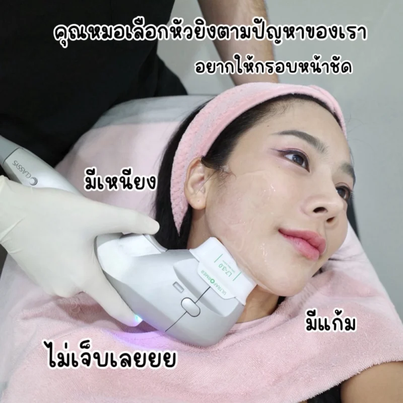 Ultraformer กี่ช็อตเห็นผล