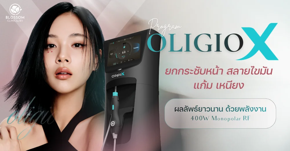 โปรแกรม Oligio X