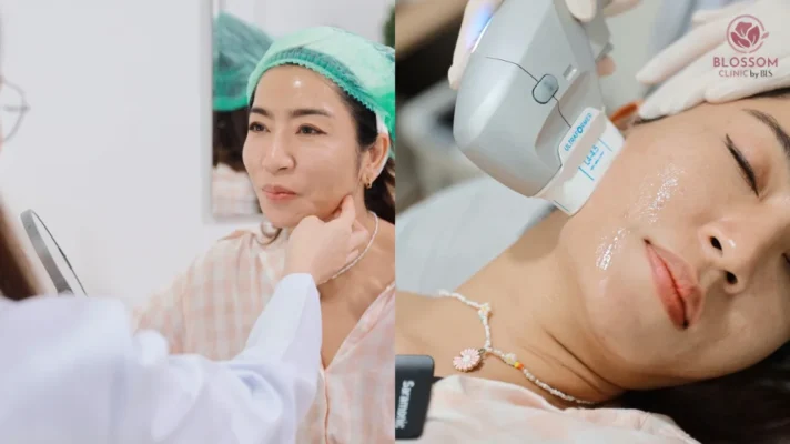 โปรแกรมยกกระชับ Ultraformer III ที่ Blossom Clinic by BLS