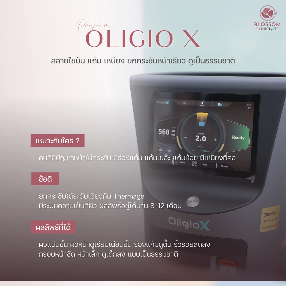 Program Oligio X คืออะไรและใช้งานอย่างไร