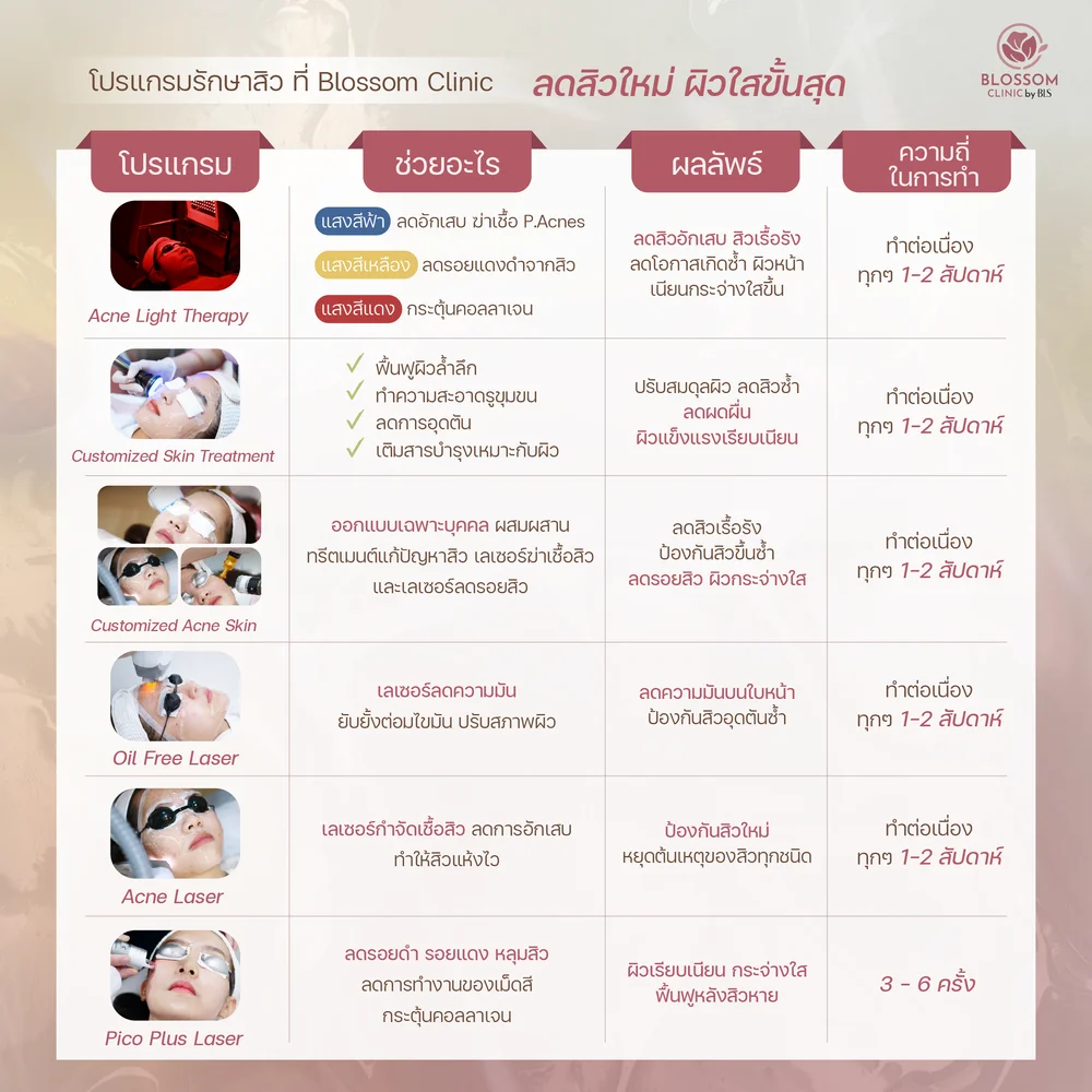 คลินิกสิวใกล้ฉันที่ใช้เทคโนโลยีเลเซอร์รักษาสิว