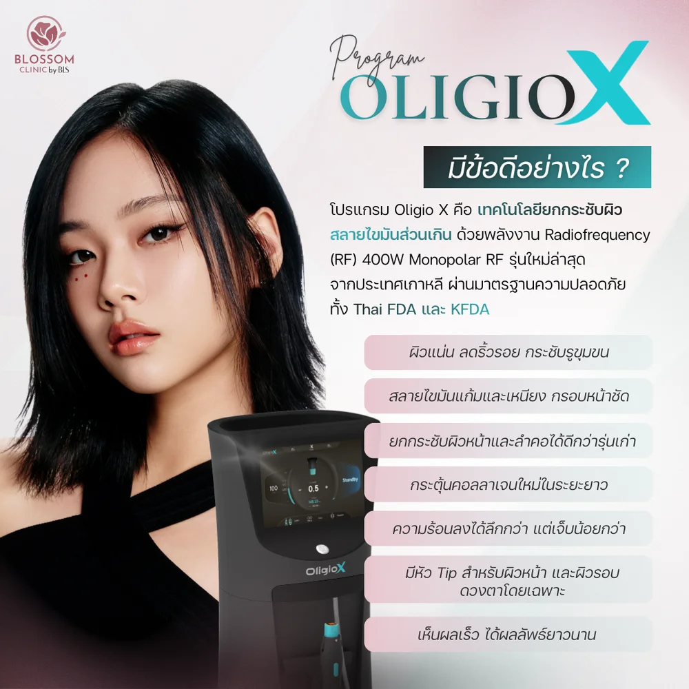 โปรแกรม Oligio X คืออะไรและใช้งานอย่างไร