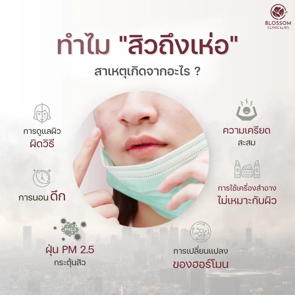 PM2.5 ทำให้สิวเห่อ คลินิกสิว ใกล้ฉันที่ไหนดี