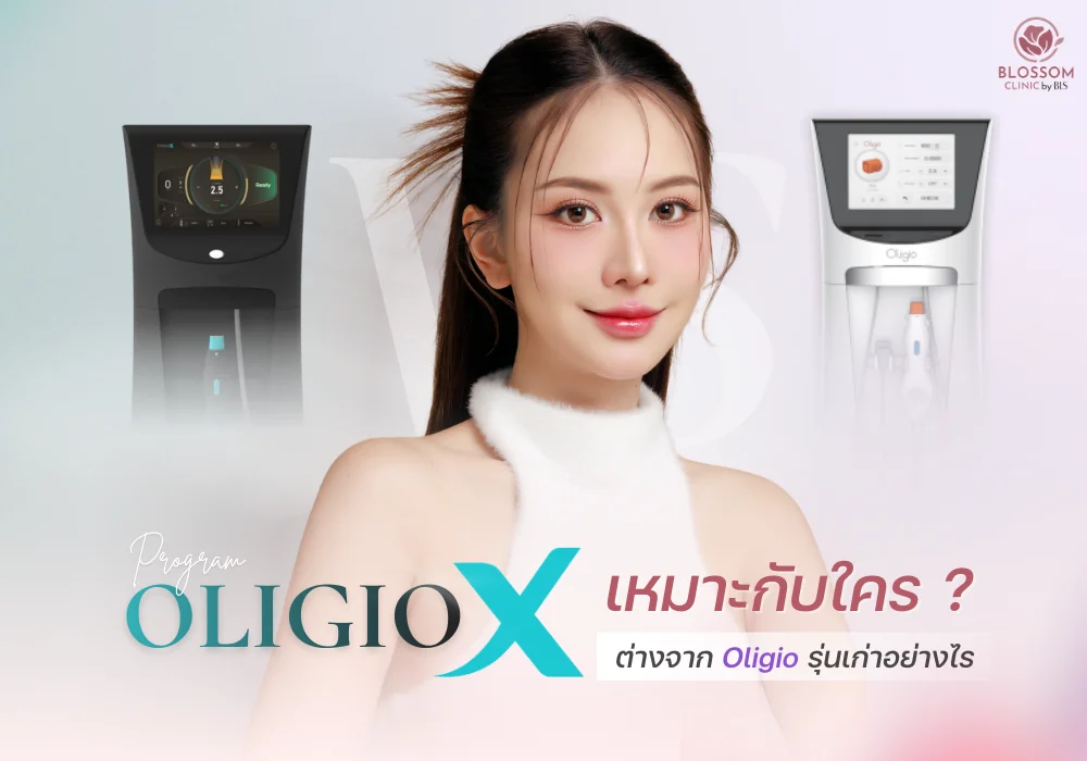 Oligio X เหมาะกับใคร? ต่างจาก Oligio รุ่นเก่าอย่างไร?