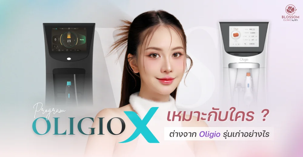 Oligio X เหมาะกับใคร? ต่างจาก Oligio รุ่นเก่าอย่างไร?