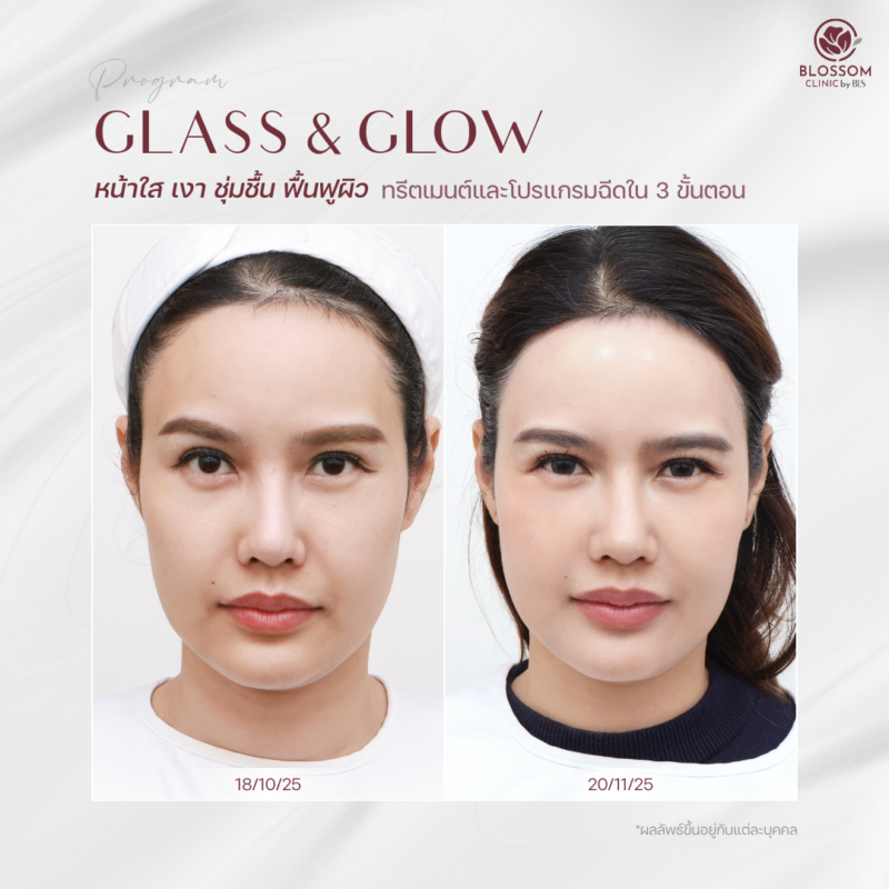 รีวิวโปรแกรม Glass & Glow