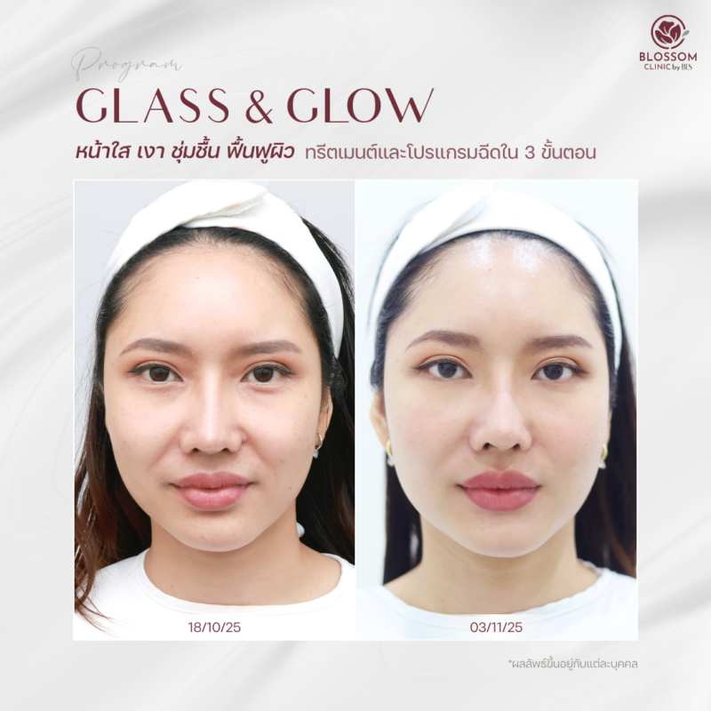 รีวิวโปรแกรม Glass & Glow