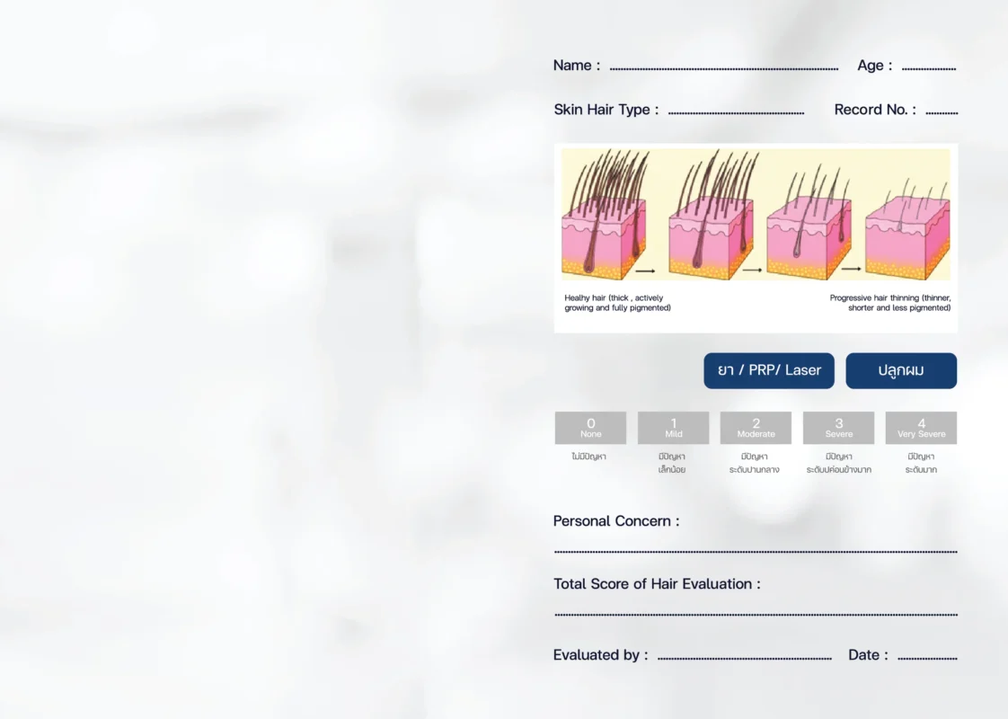ตรวจสภาพเส้นผม Hair Assessment ด้วย Dermoscopy