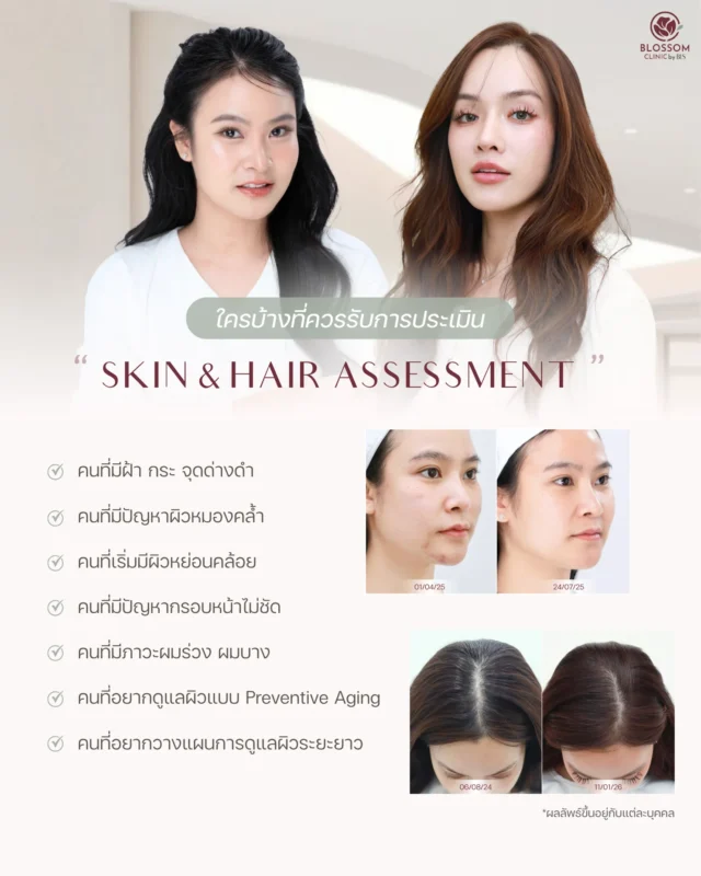 โปรแกรมวิเคราะห์ผิวหน้าและผม Skin & Hair Assessment เหมาะกับใคร