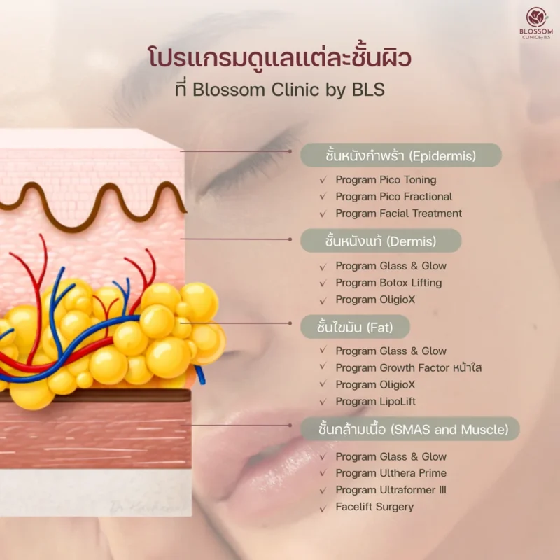 โปรแกรมยกกระชับหน้าแบบไม่ต้องผ่าตัดมีข้อดีข้อเสียอย่างไร