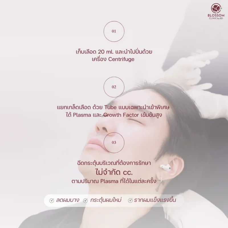 วิเคราะห์ปัญหาผม และรับบริการโปรแกรม Anti-Hair Loss