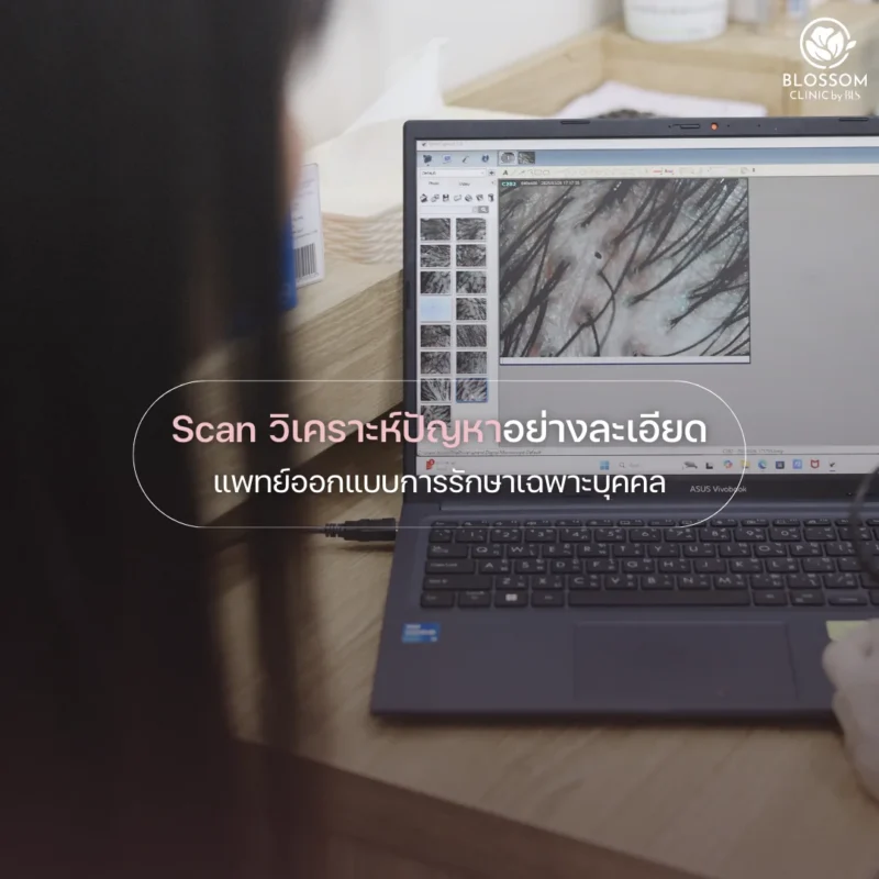 Skin & Hair Assessment โแปรแกรมวิเคราะห์ผิวหน้าอย่างแม่นยำ