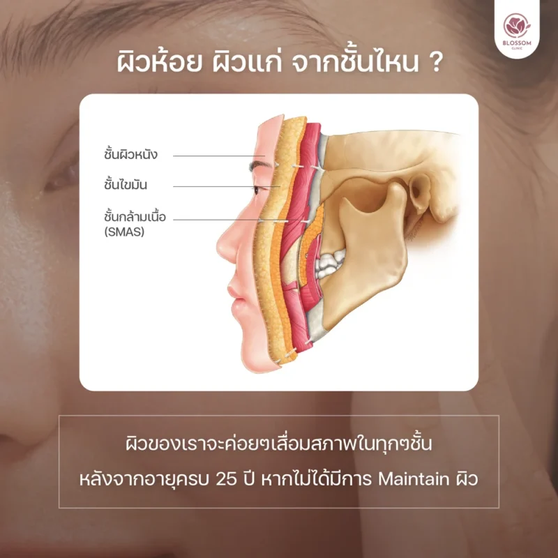 ชั้นผิวหนัง มีอะไรบ้าง? โปรแกรมยกกระชับผิวหน้าเหมาะกับใครบ้าง