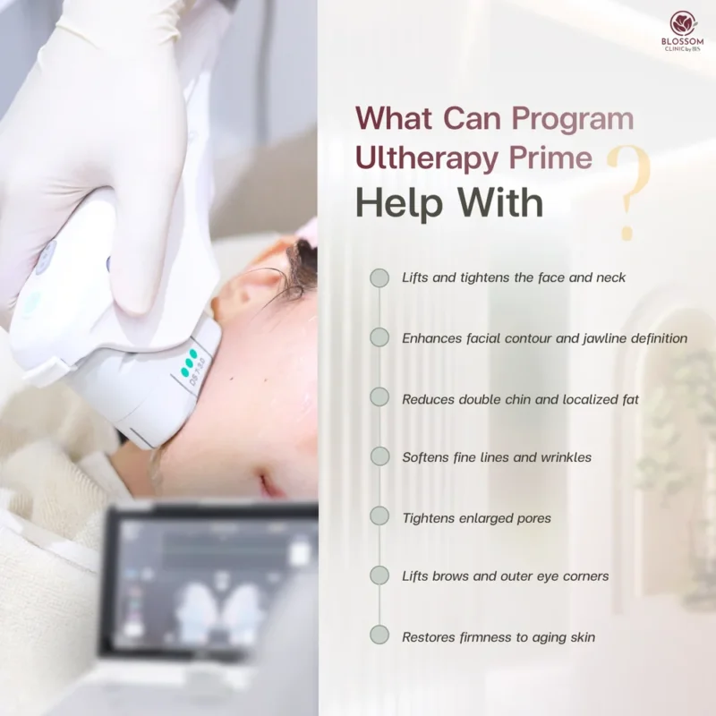 Does Program Ulthera Really Work? | Ulthera Prime Bangkok