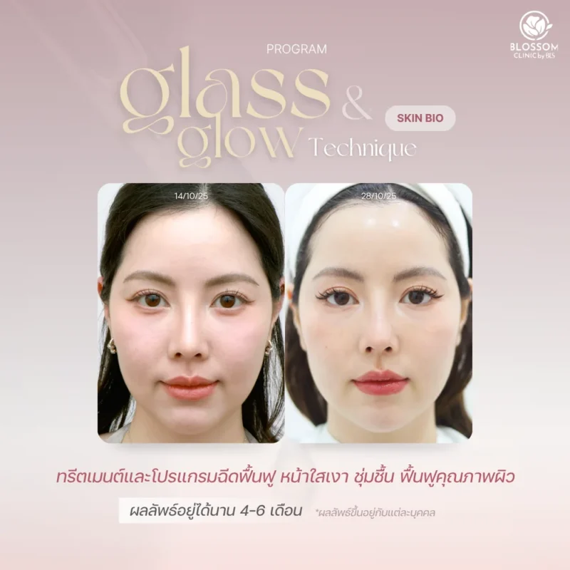 Skin Rejuvenation เพื่อผิวกระจกอย่างเป็นธรรมชาติ