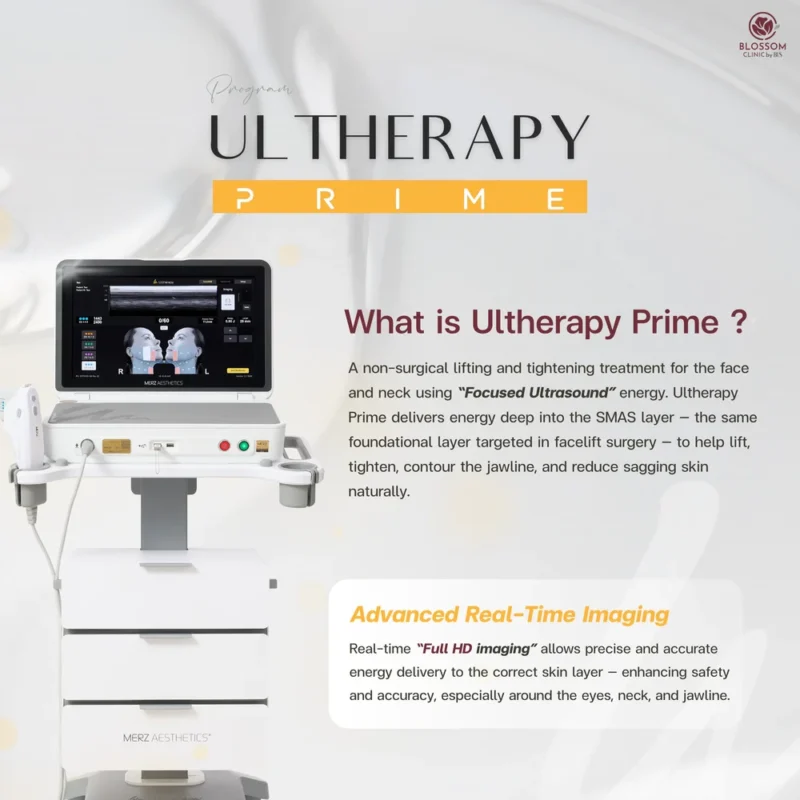 What is Program Ulthera Prime? | Ulthera Prime Bangkok