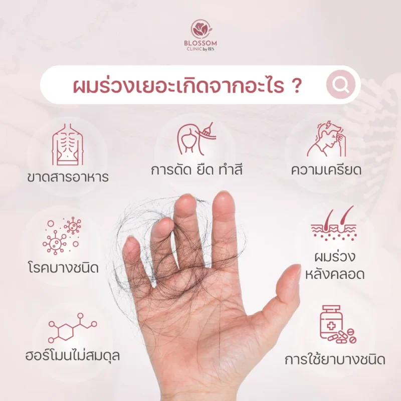 ผมร่วงหนักมาก ผมร่วงเกิดจากสาเหตุอะไร